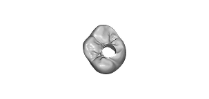 Screw-Retained Crown